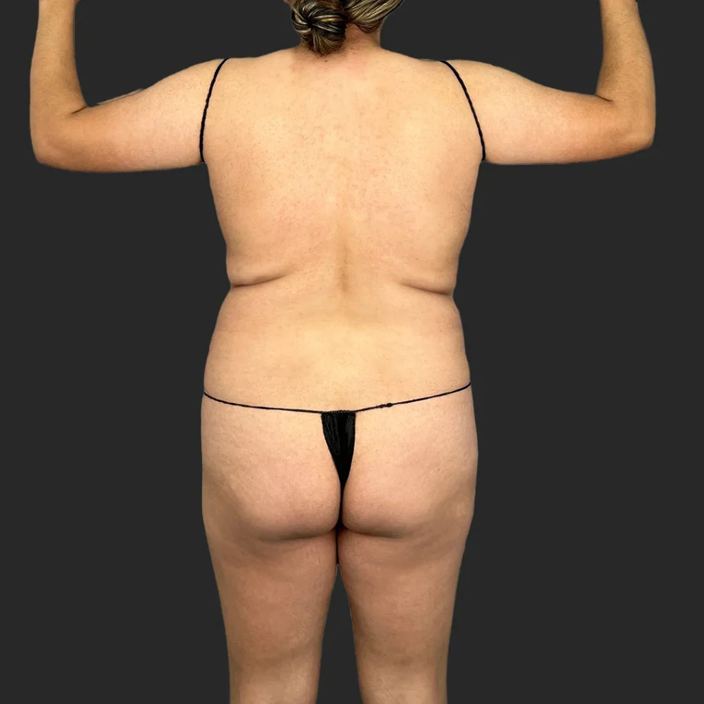 Before image