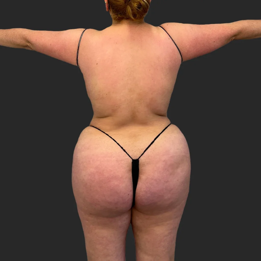 After image