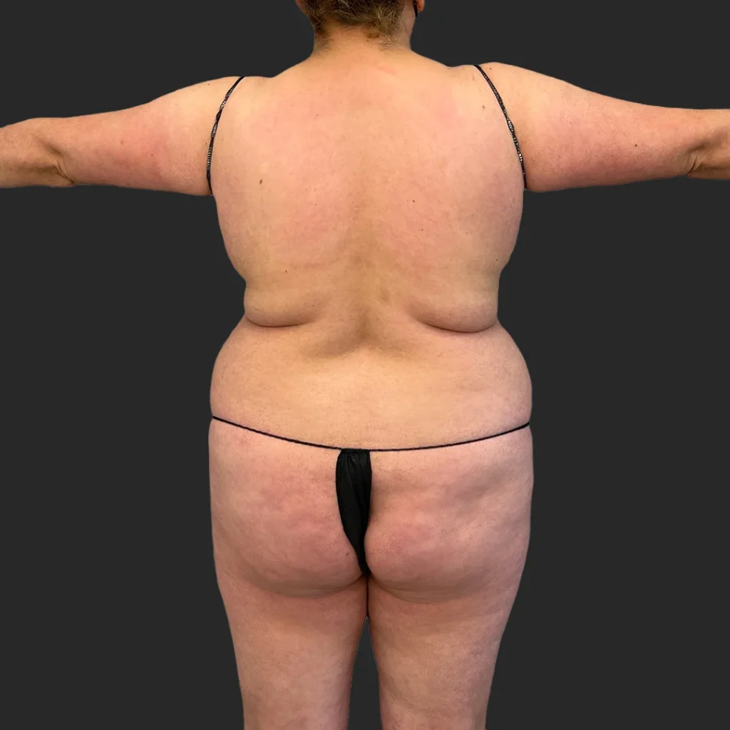 Before image