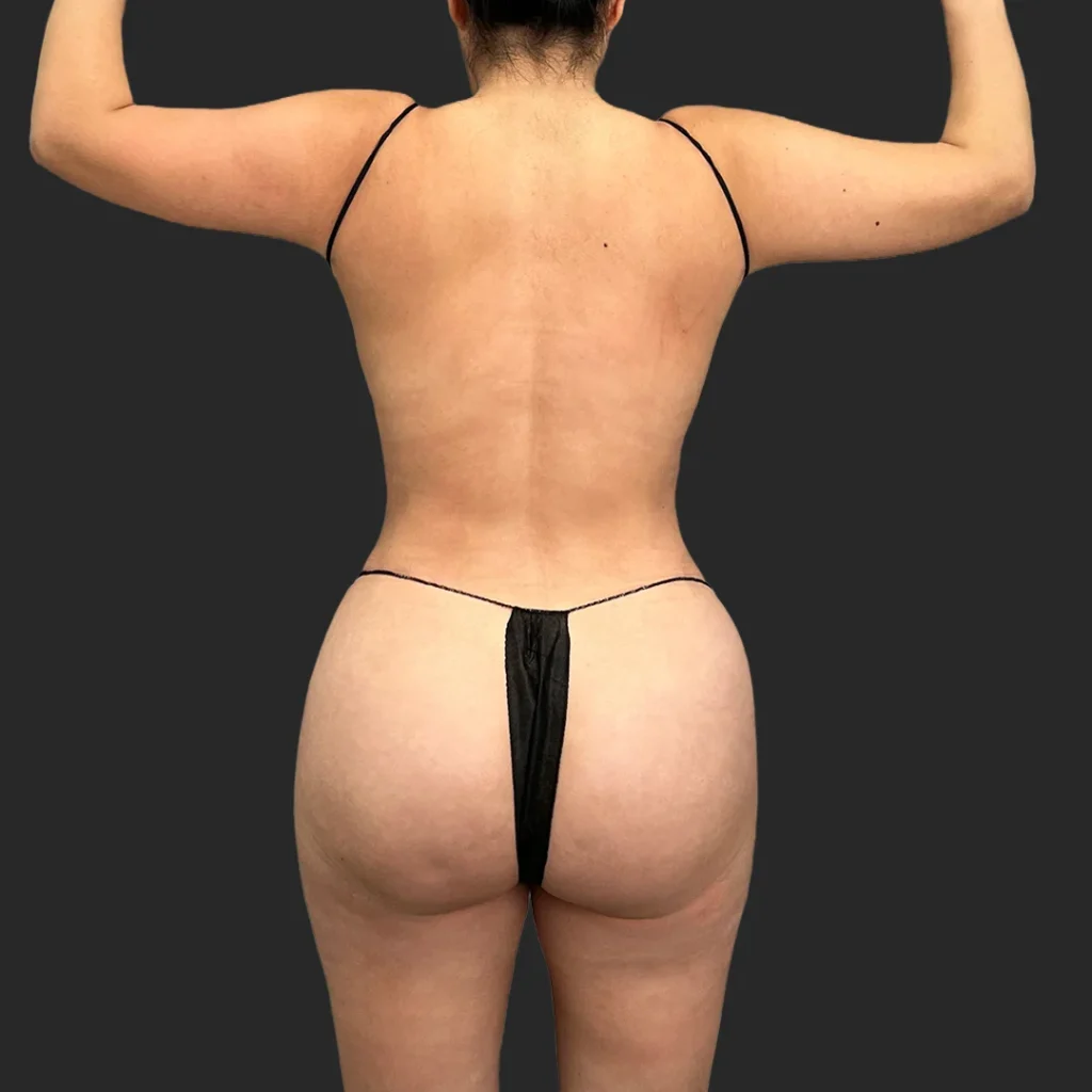After image