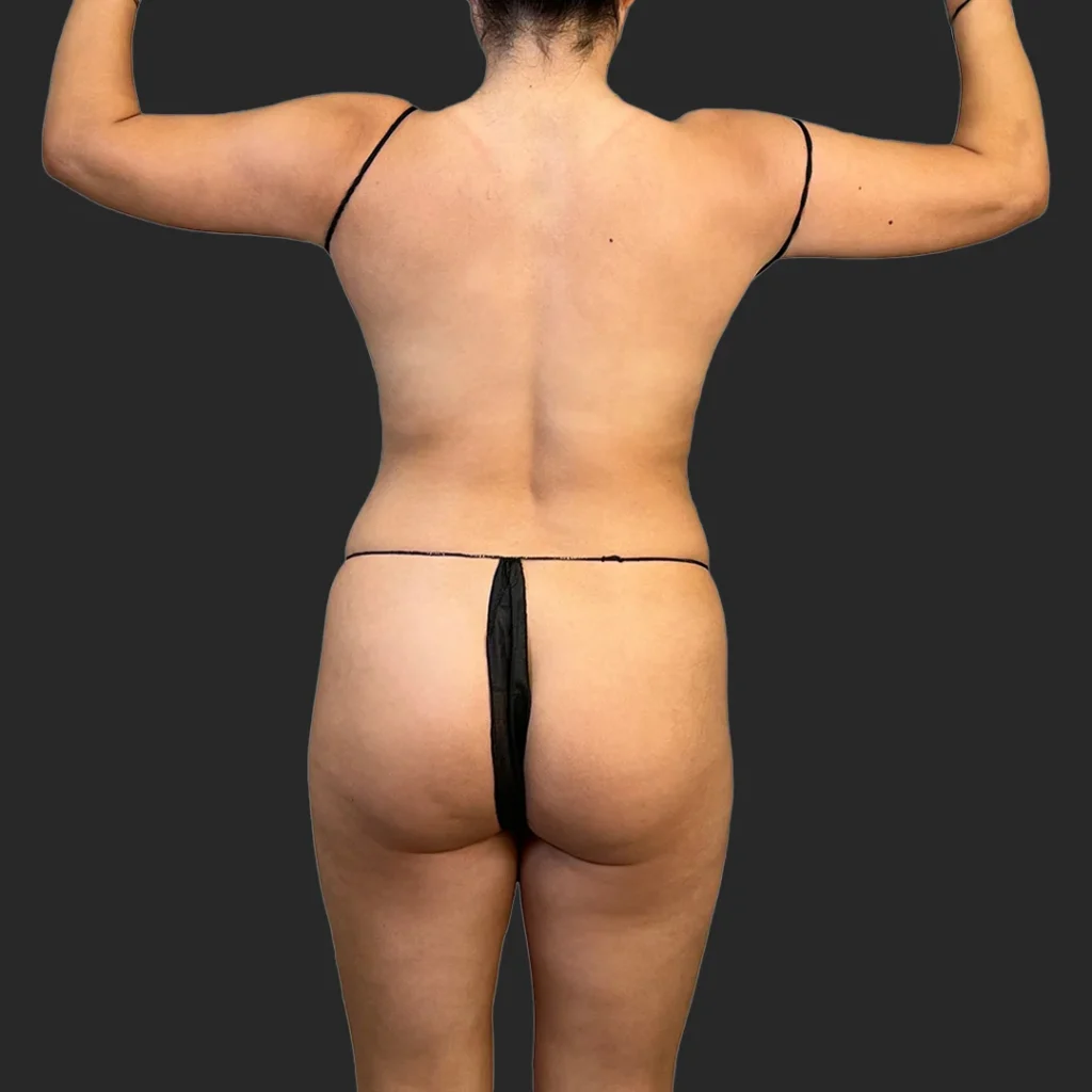 Before image