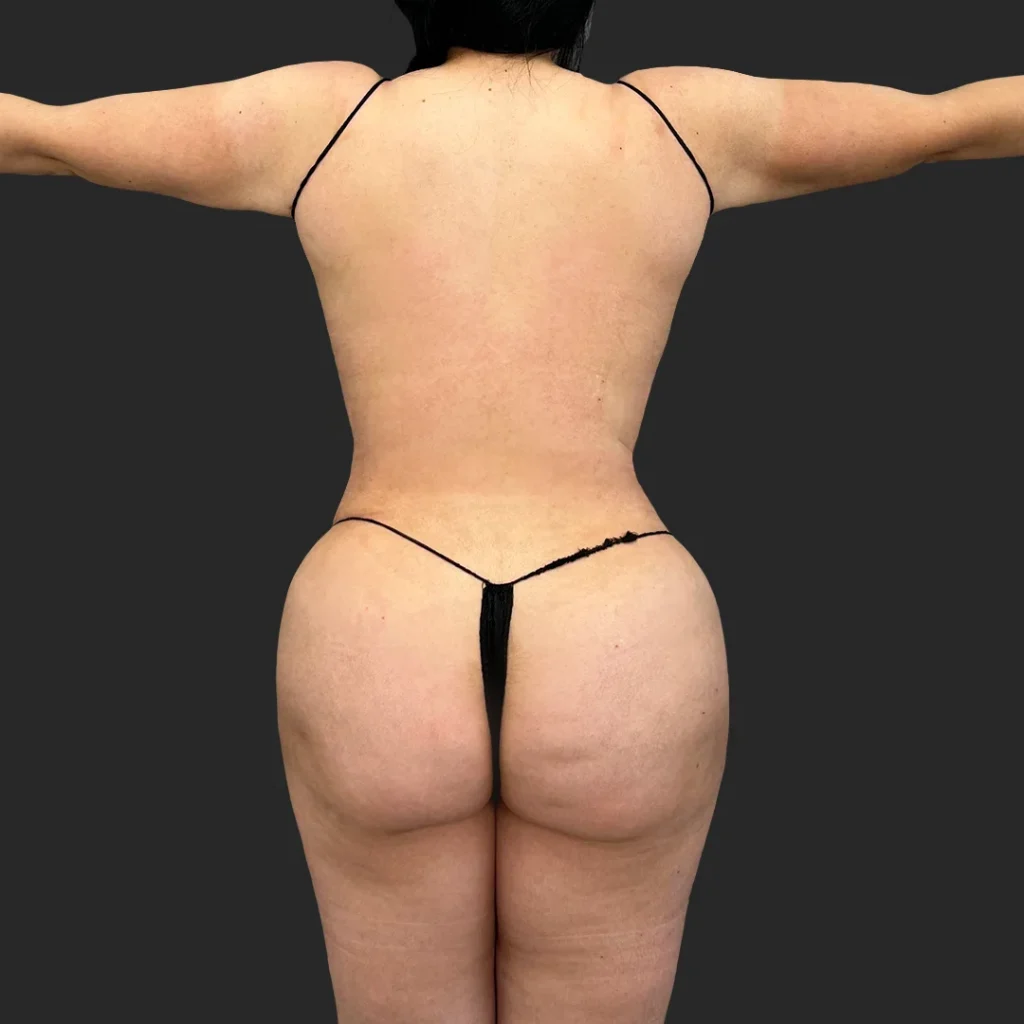 After image