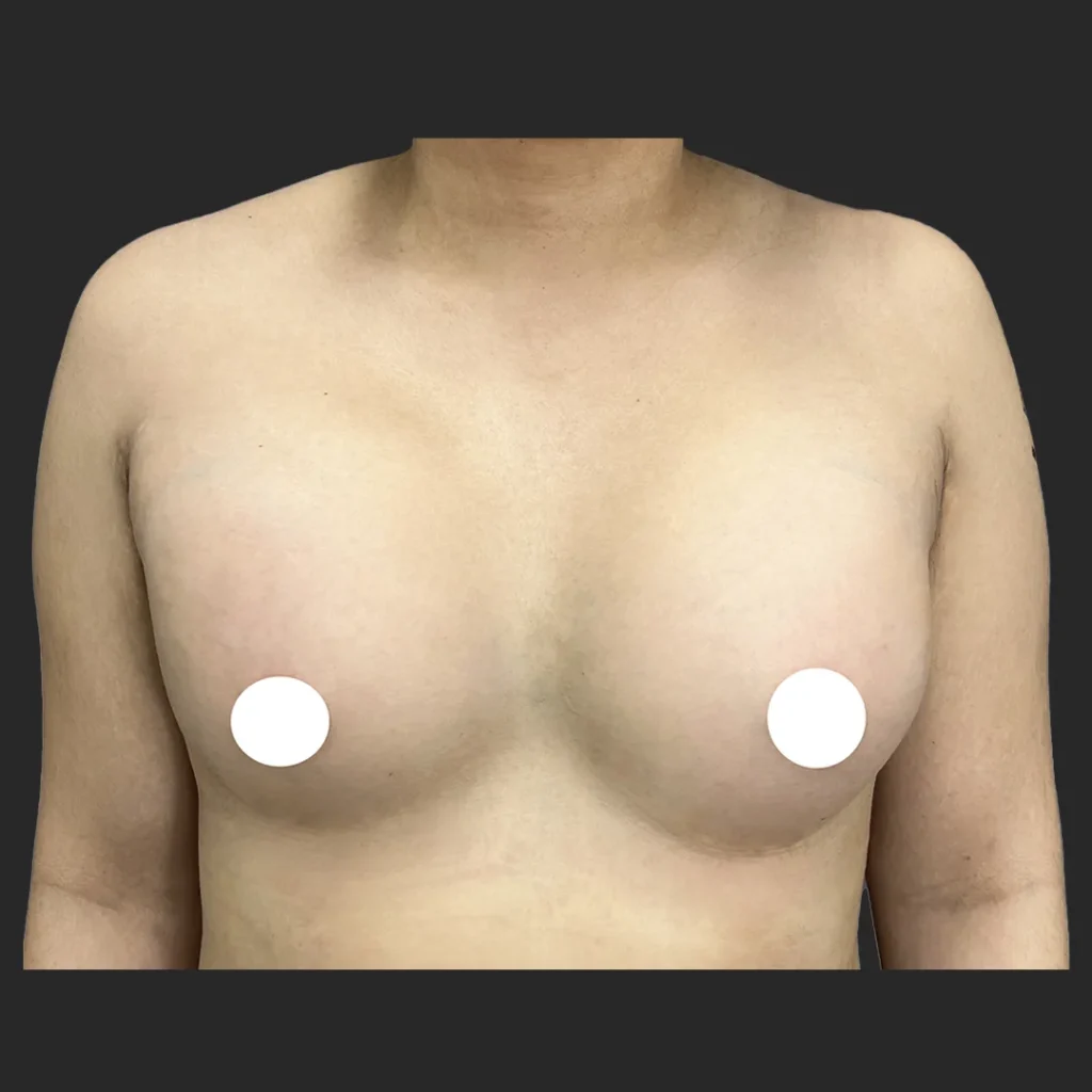 After image