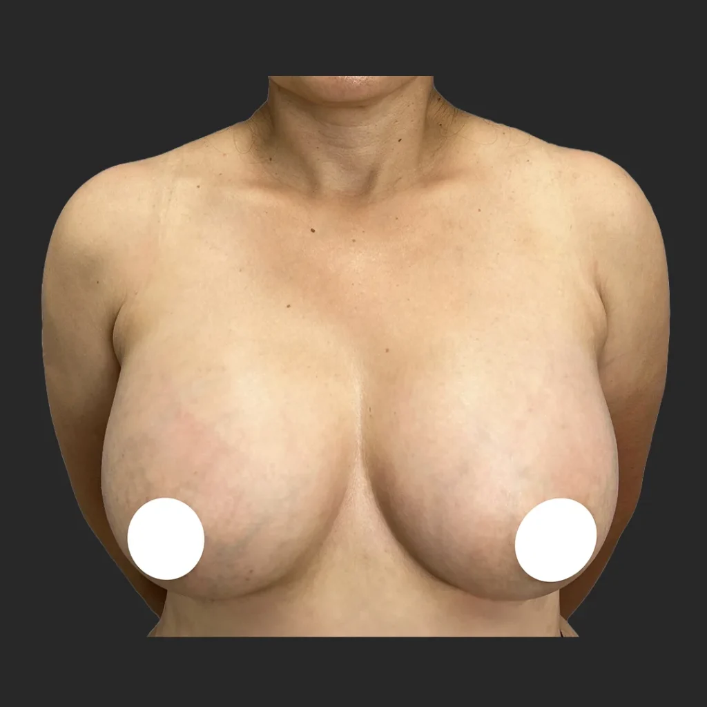 After image
