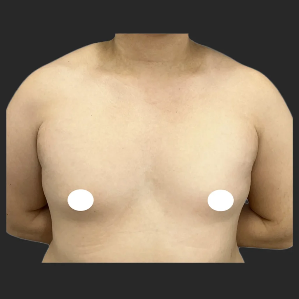 Before image
