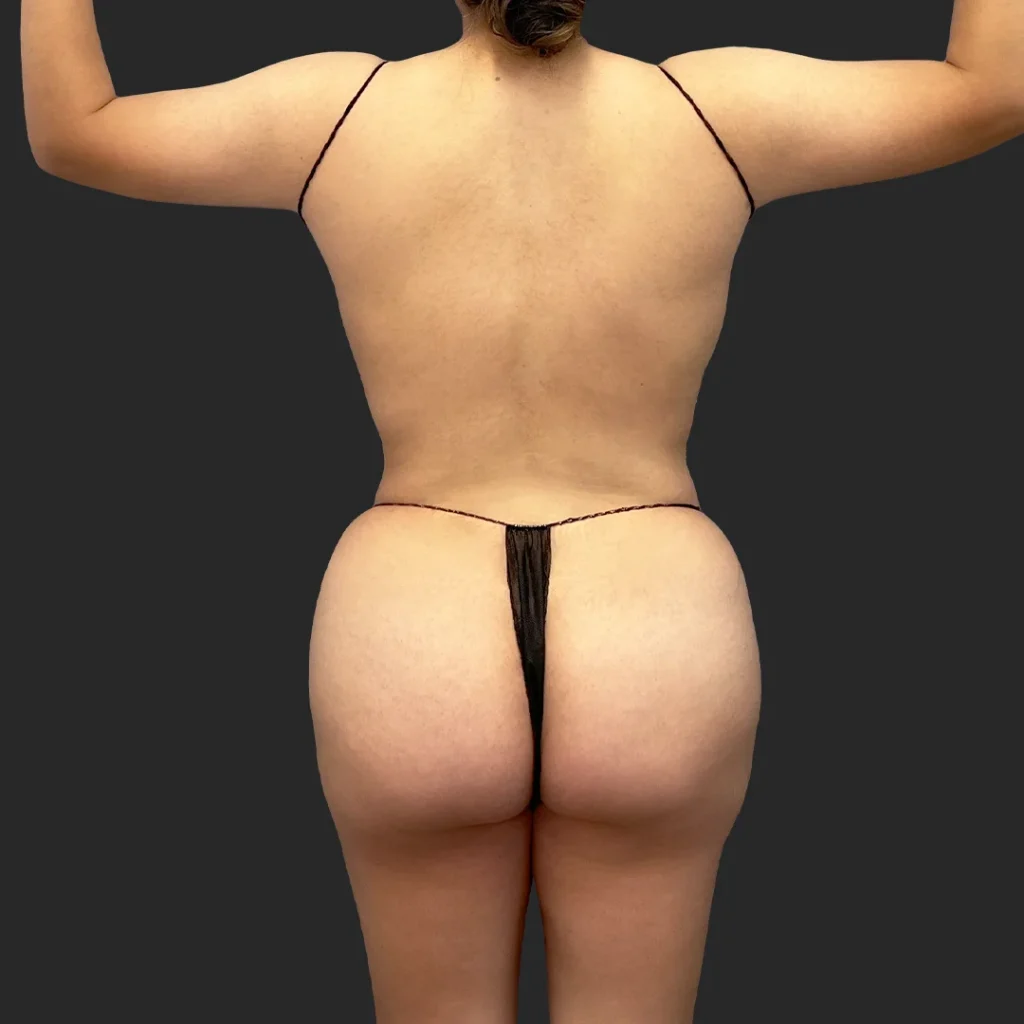 After image