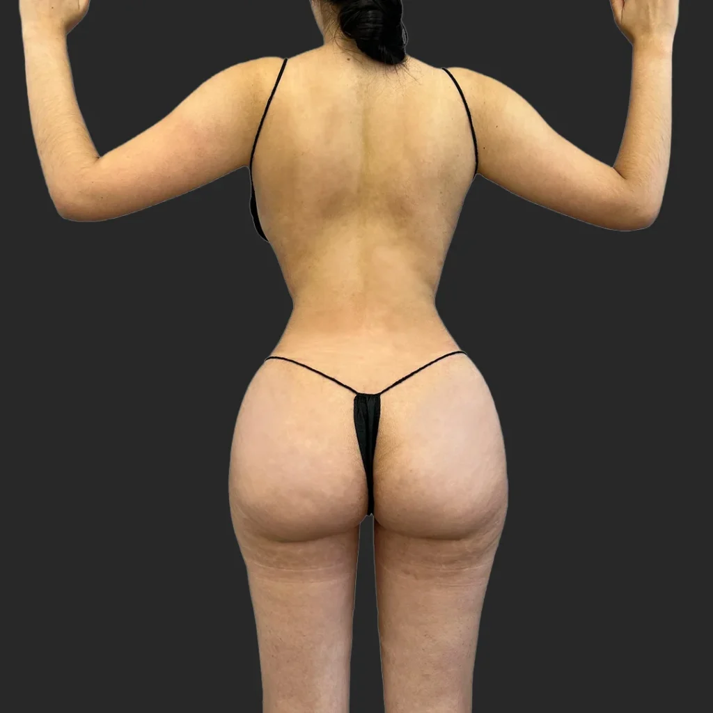 After image