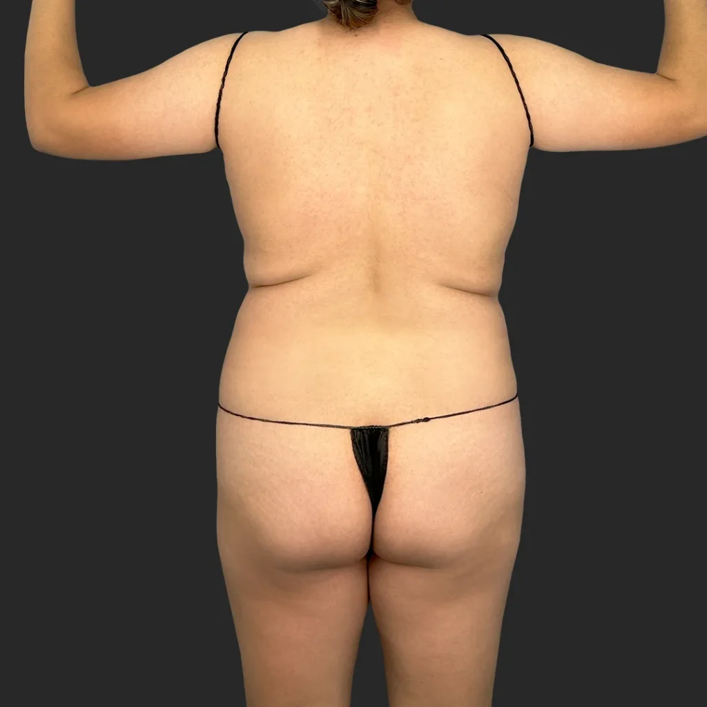 Before image
