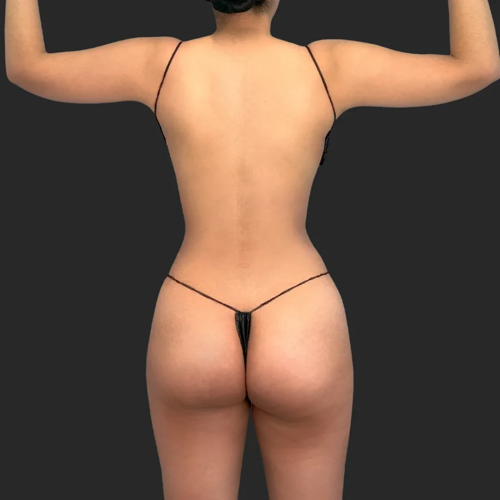 After image