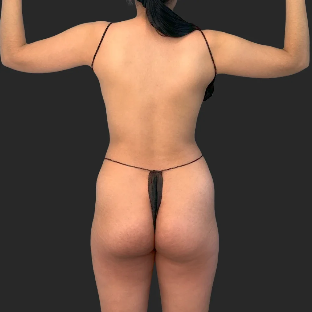 Before image