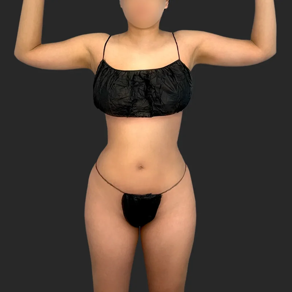 Additional after image
