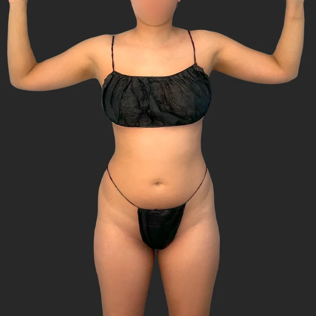 Additional before image