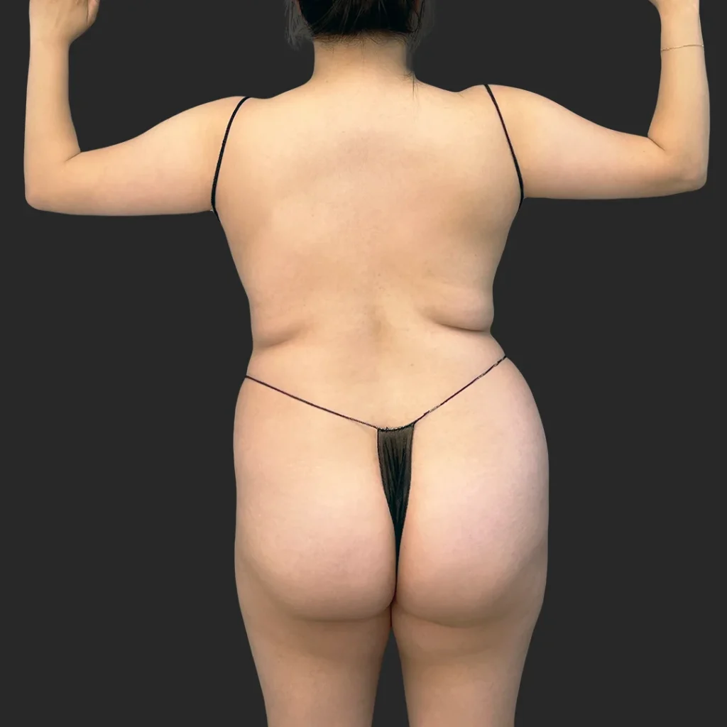 Before image