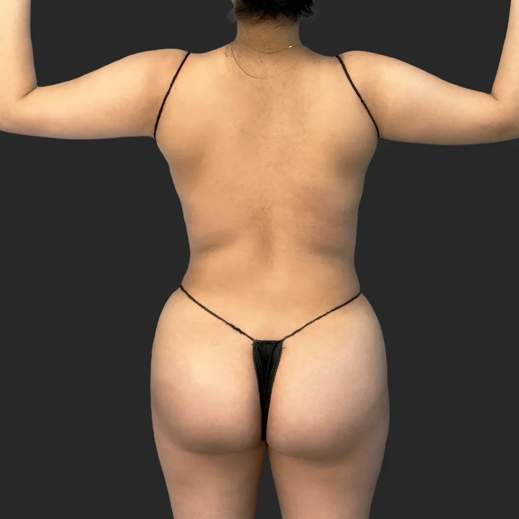 After image