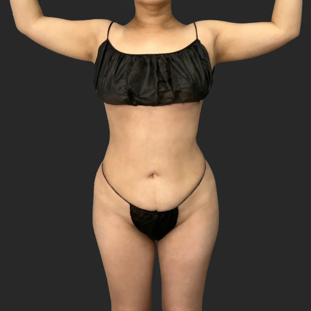 After image