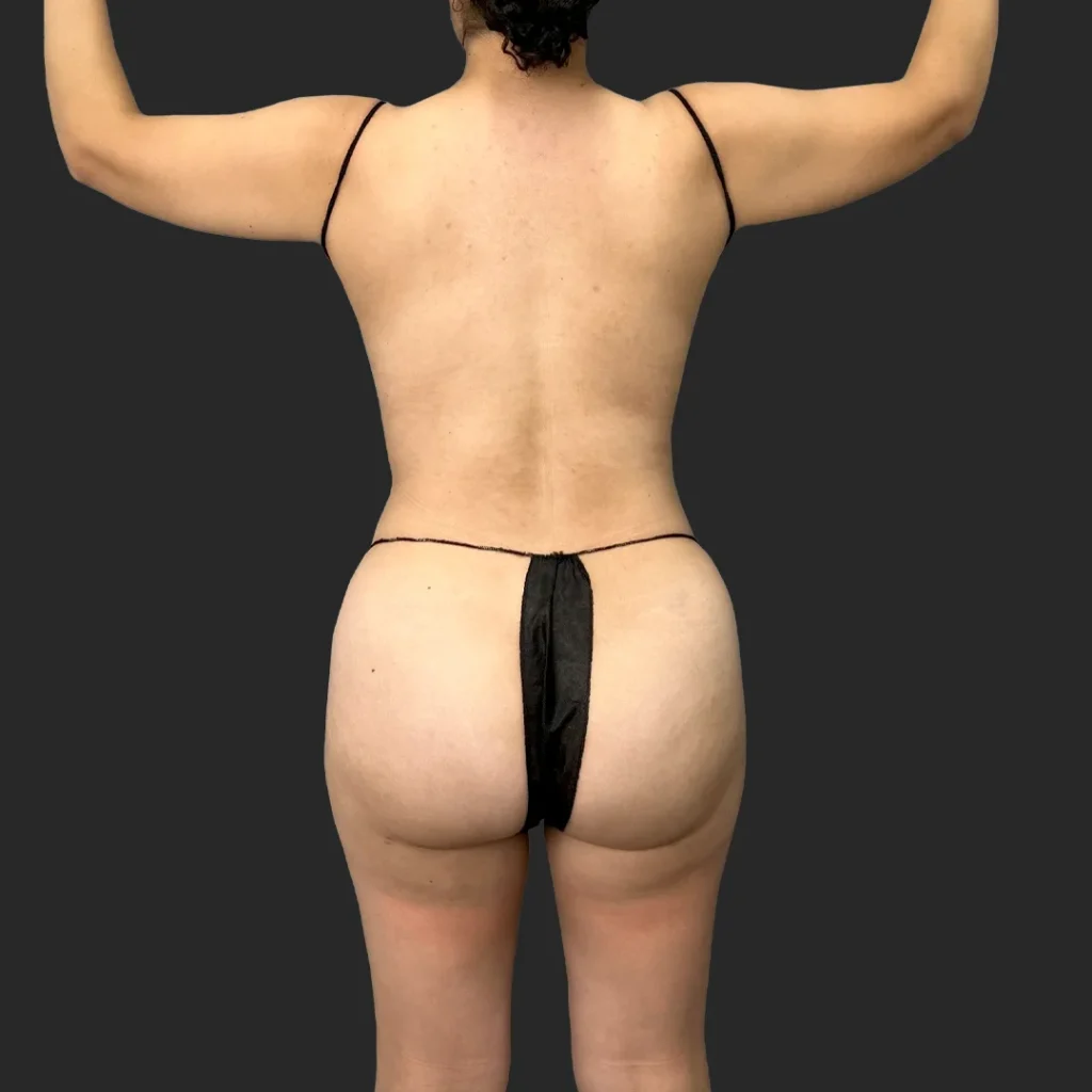 Additional after image