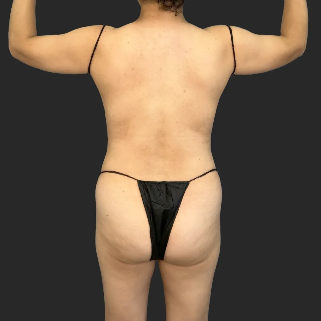 Additional before image