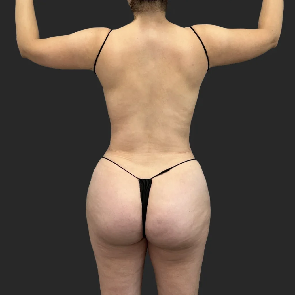 After image