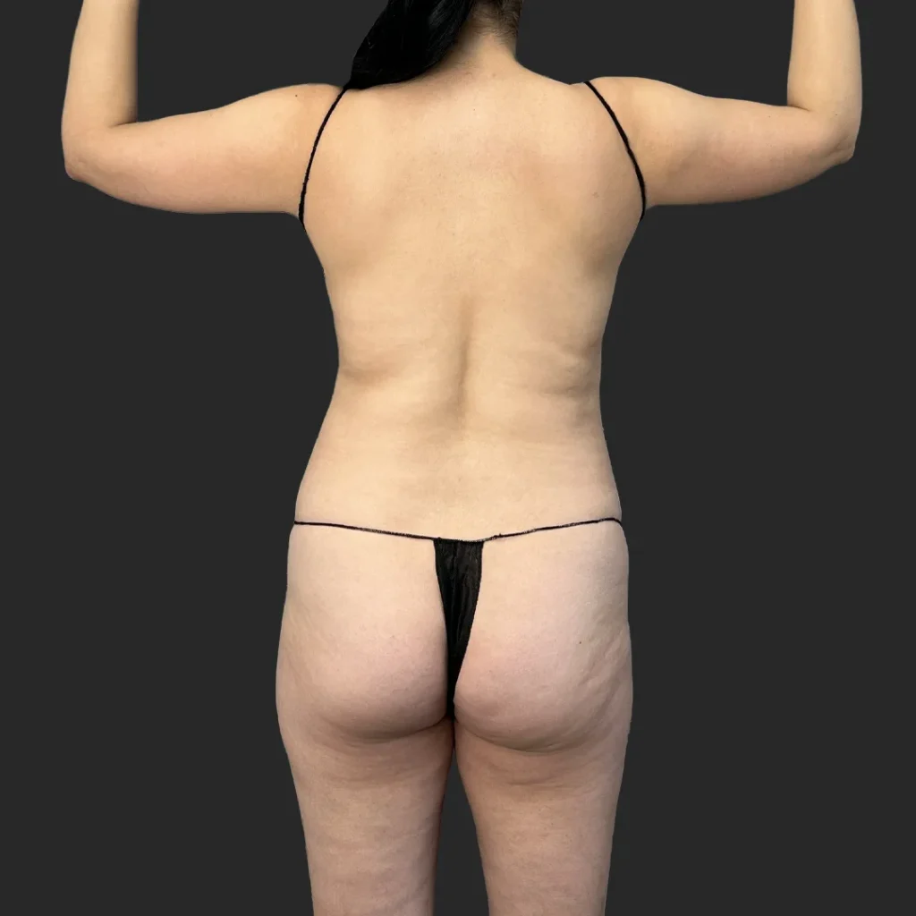 Before image