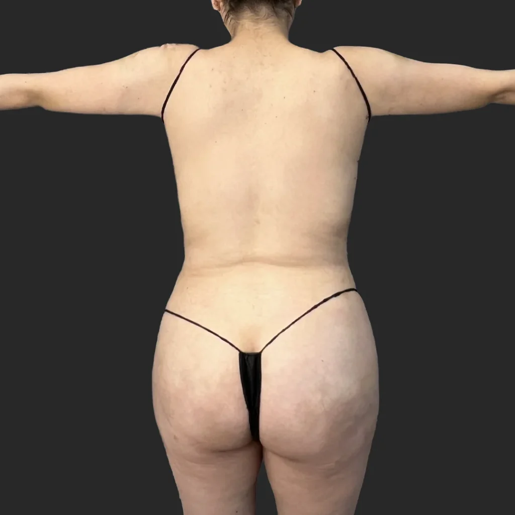 After image