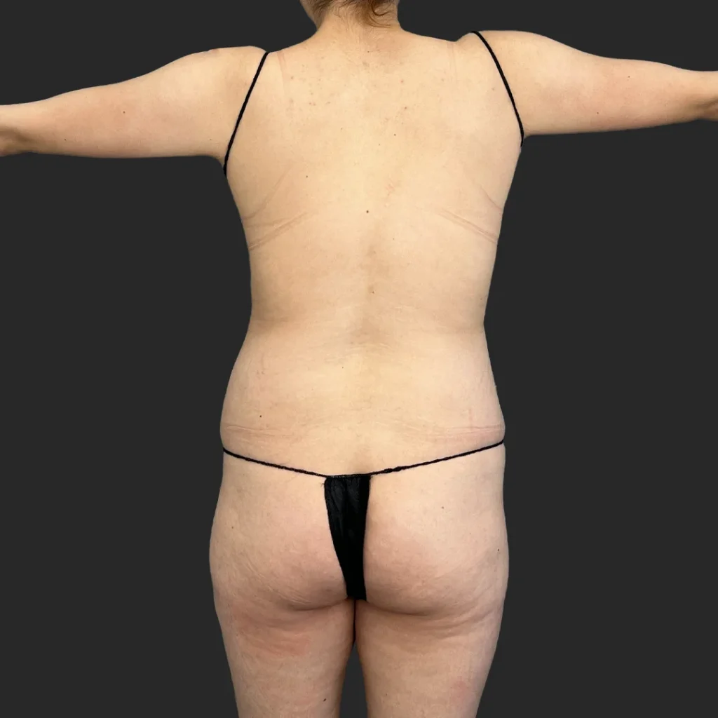 Before image
