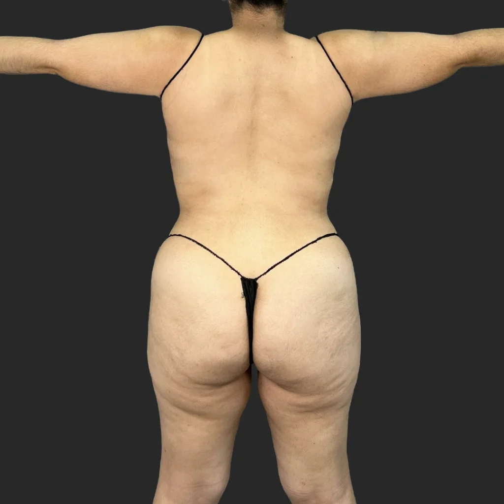 After image