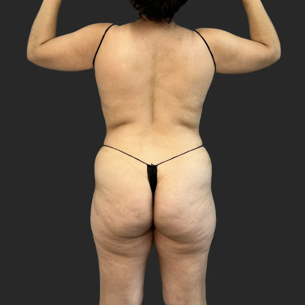 Before image