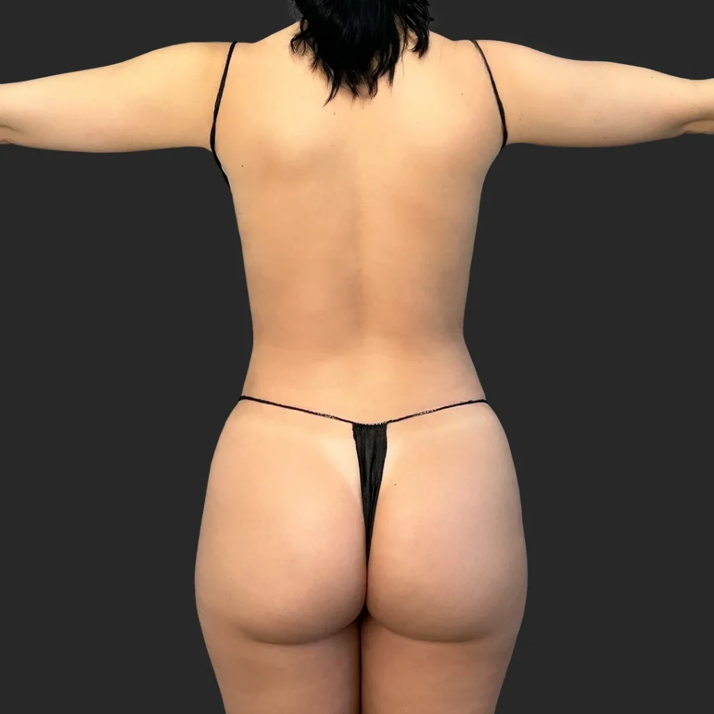 After image