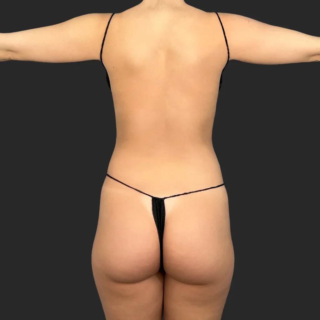 Before image