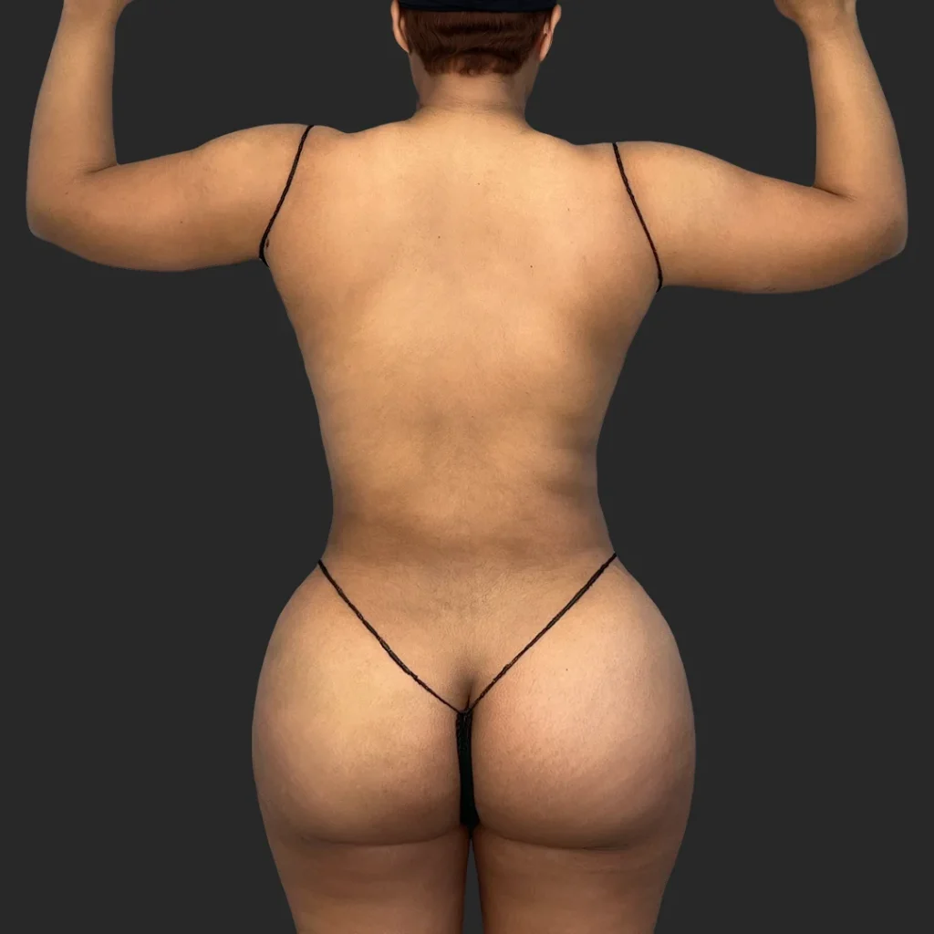 After image