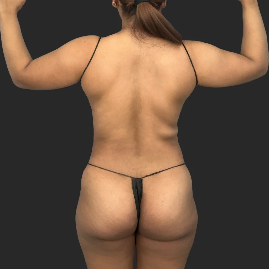 Before image