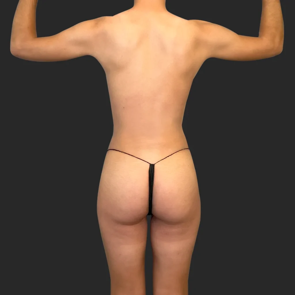 After image