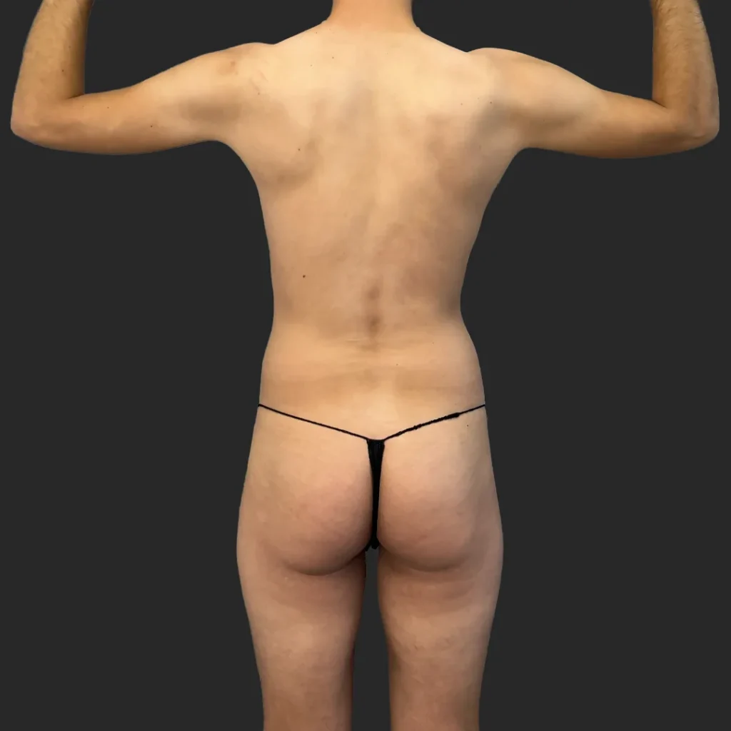 Before image