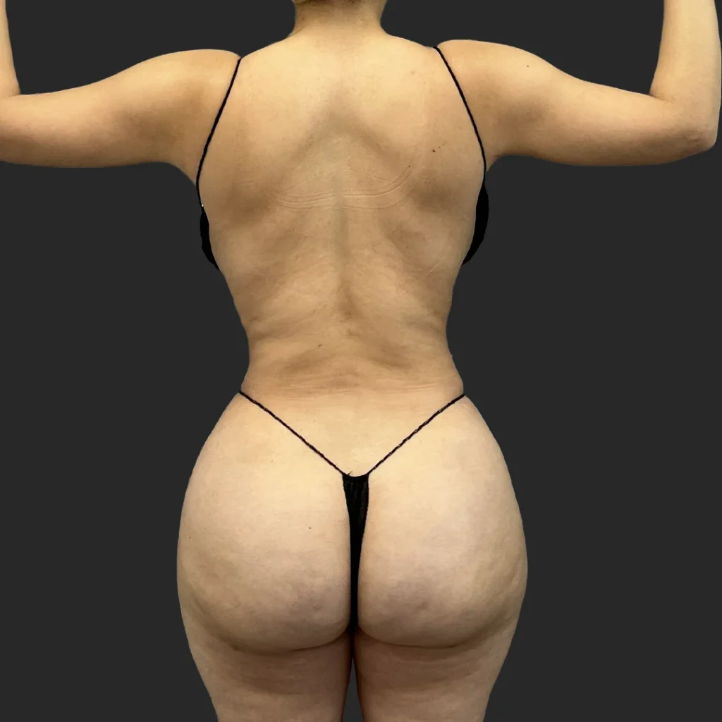 After image