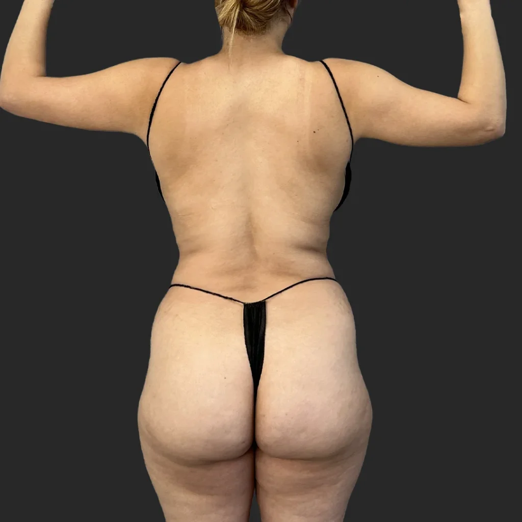 Before image