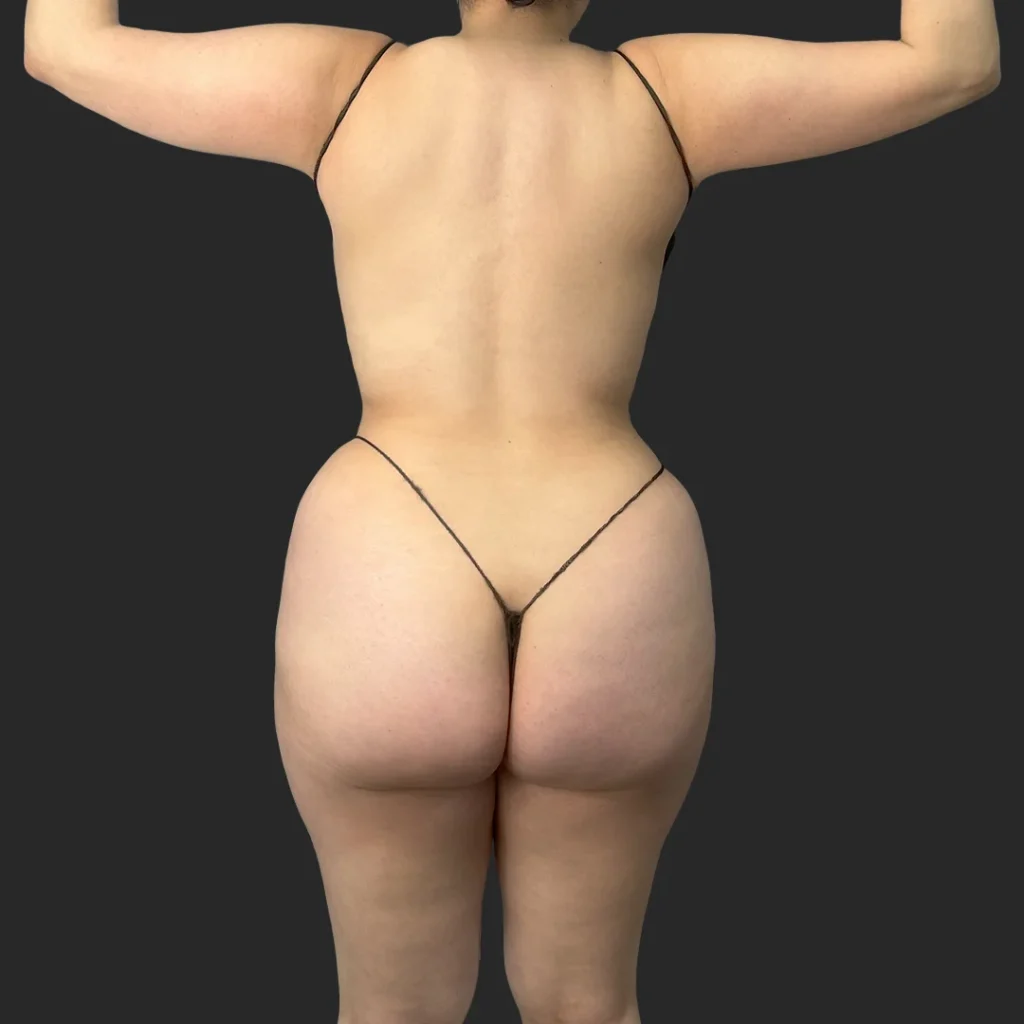 After image