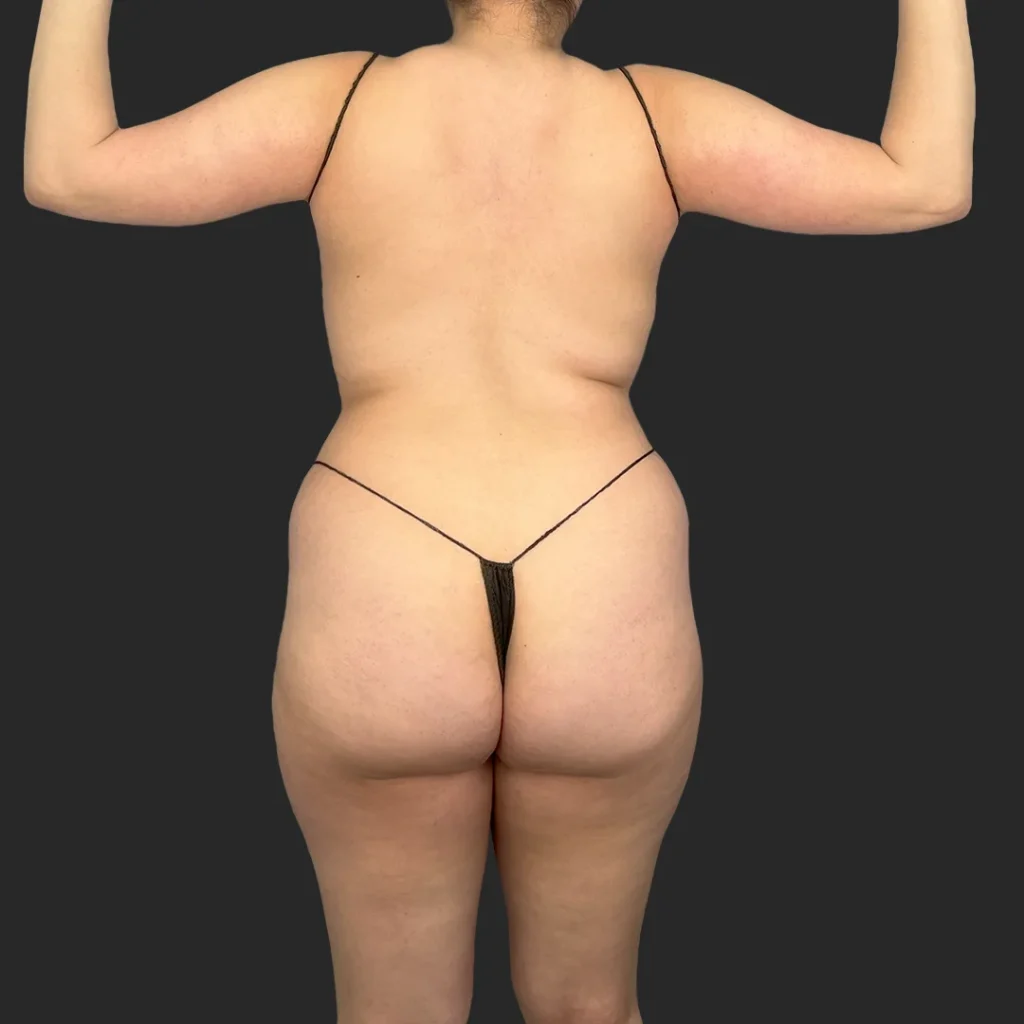 Before image