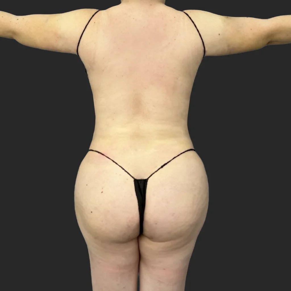 After image