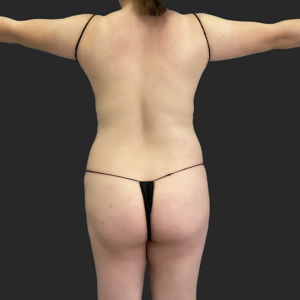 Before image