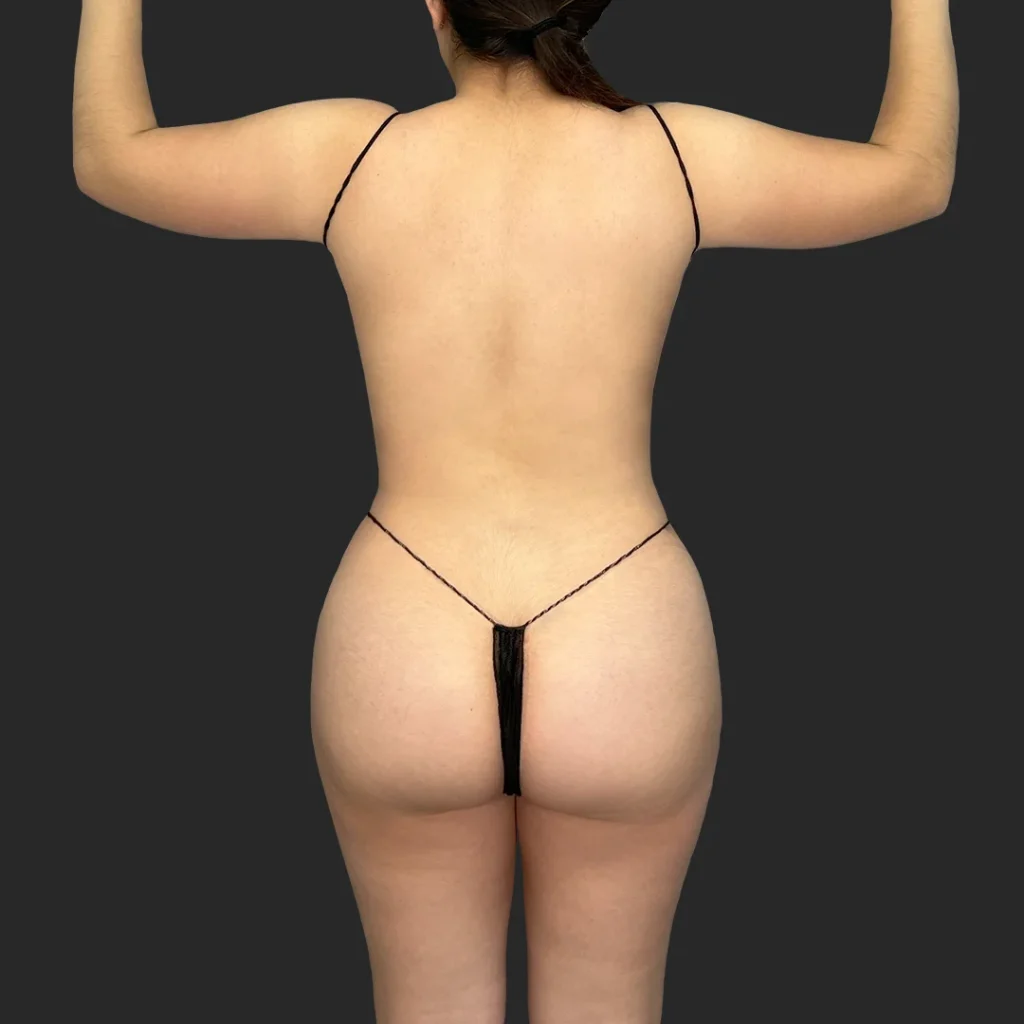After image