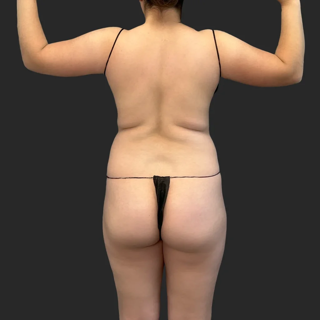 Before image