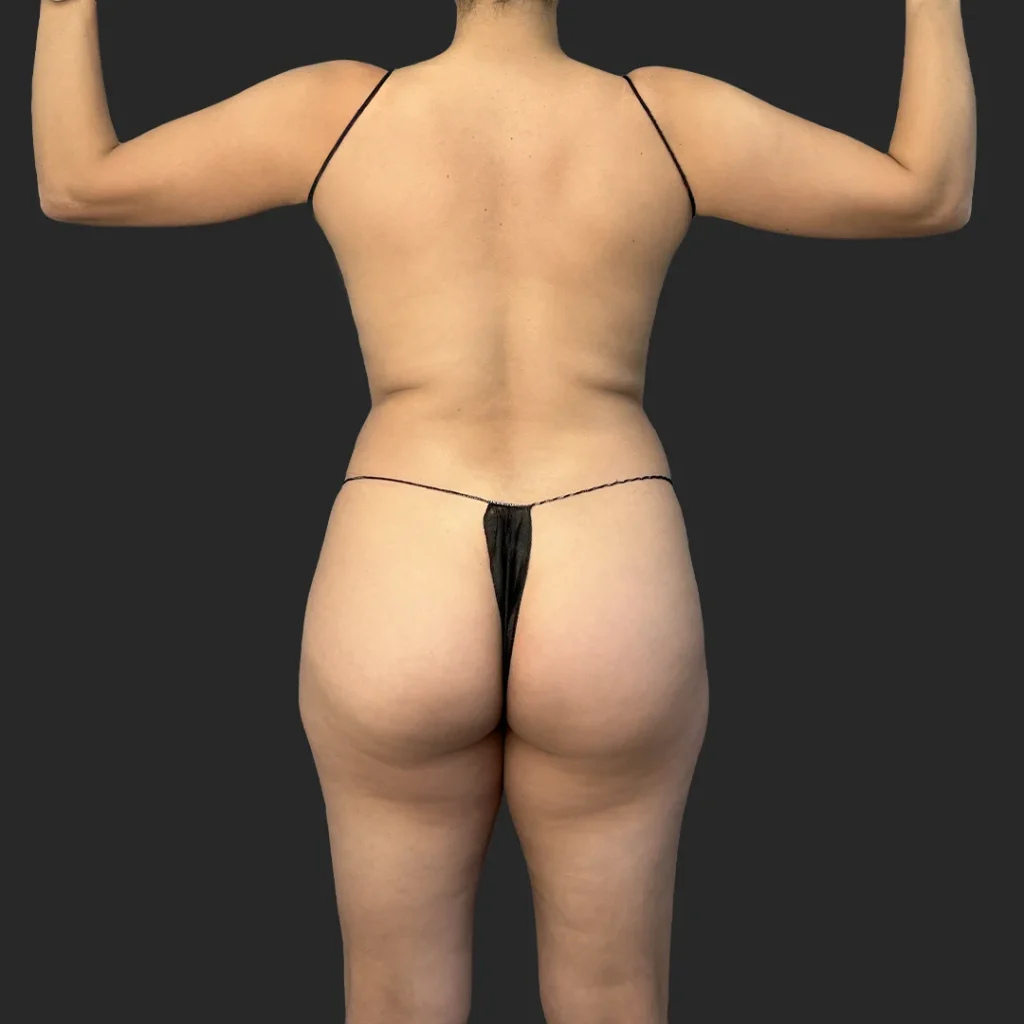 Before image