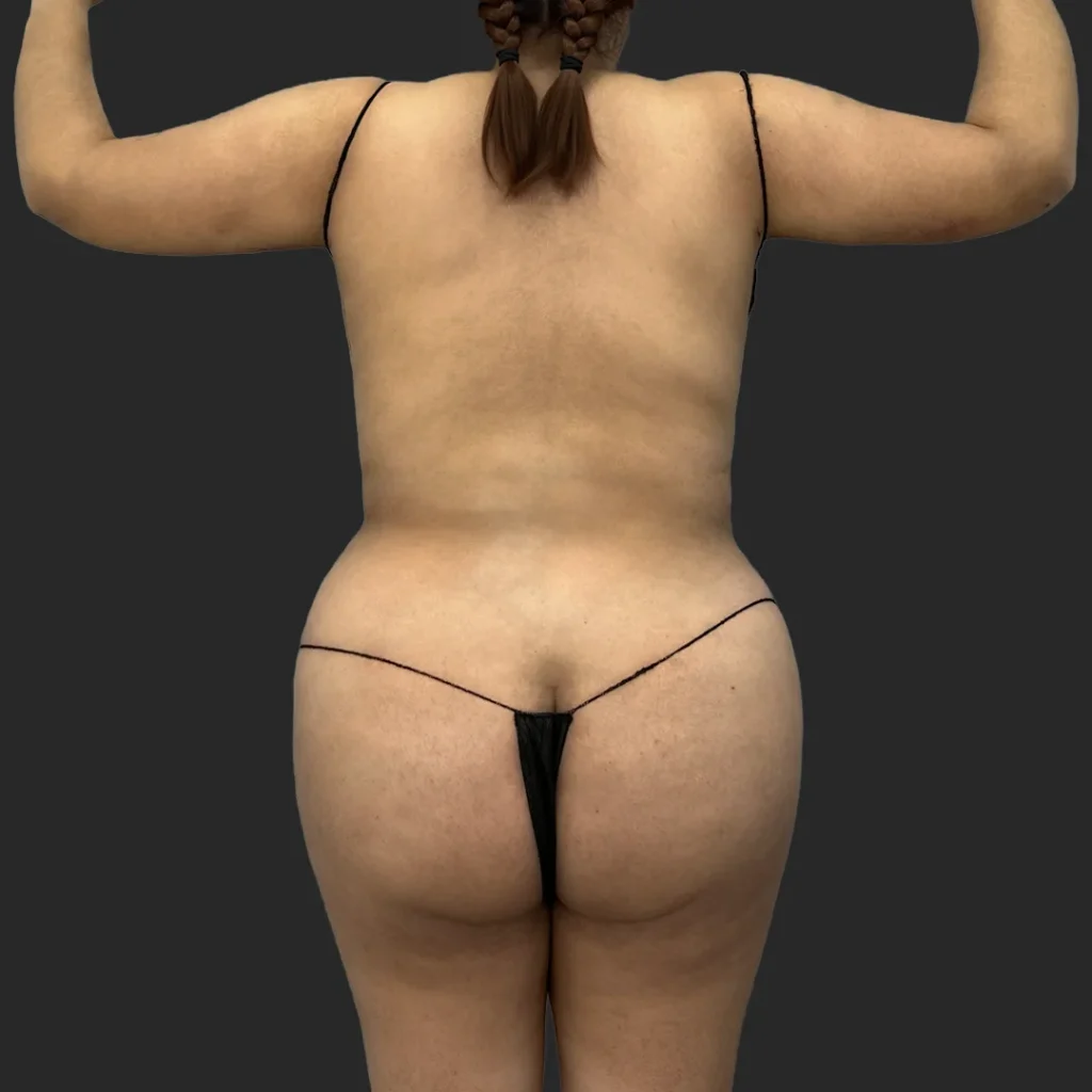 After image