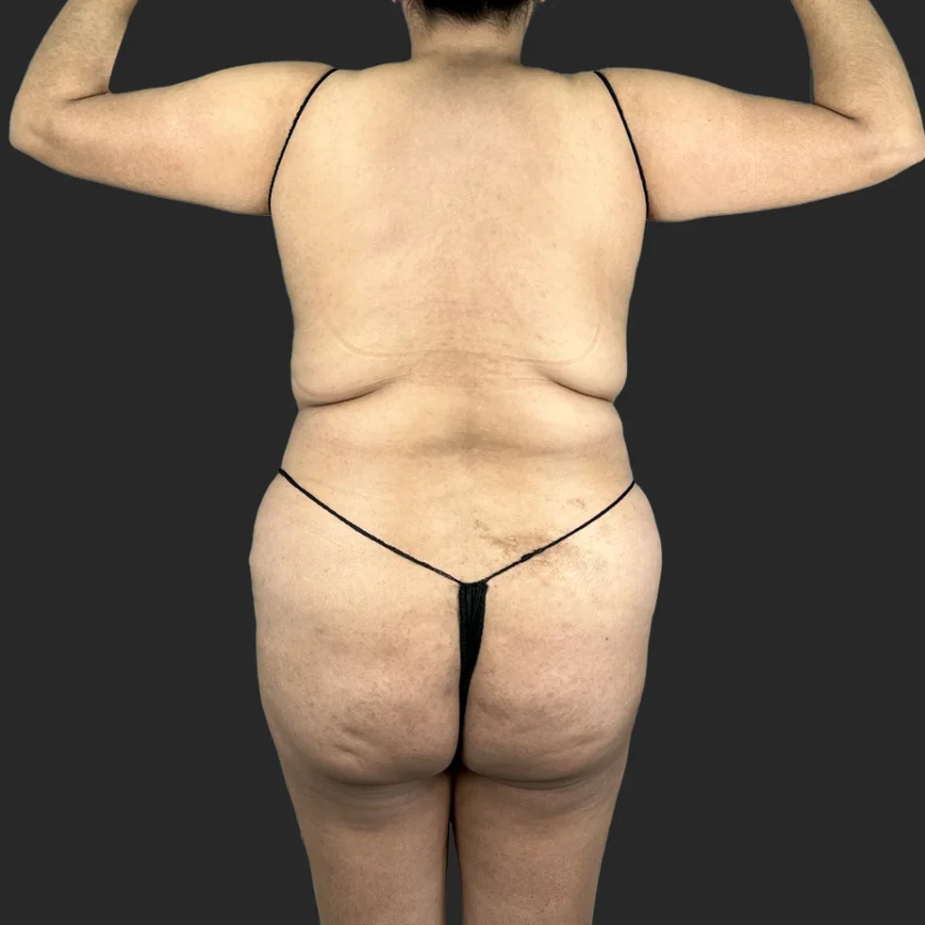 Before image