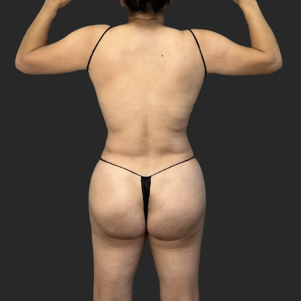 After image