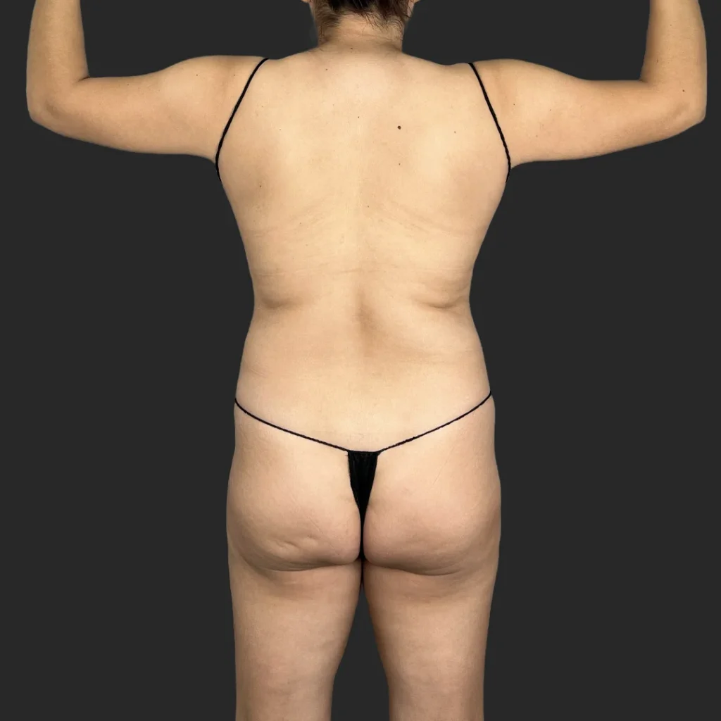 Before image