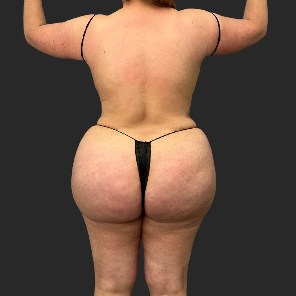 After image