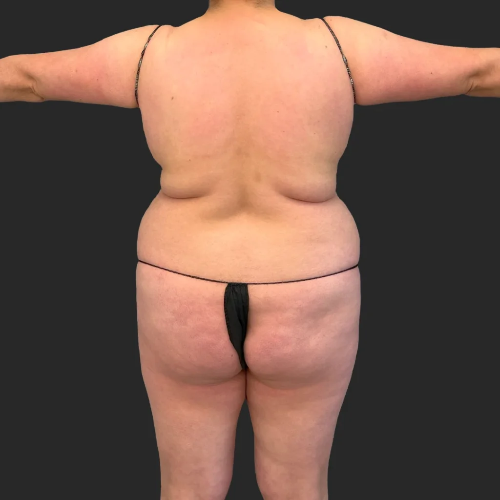 Before image