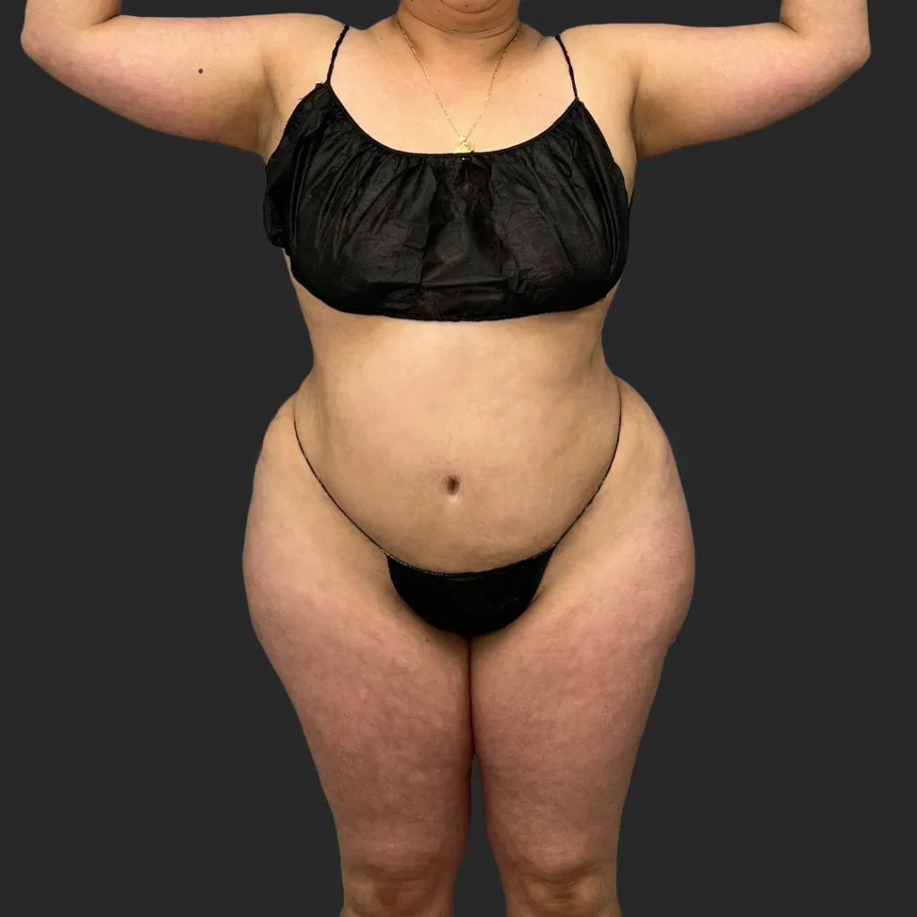 Additional after image