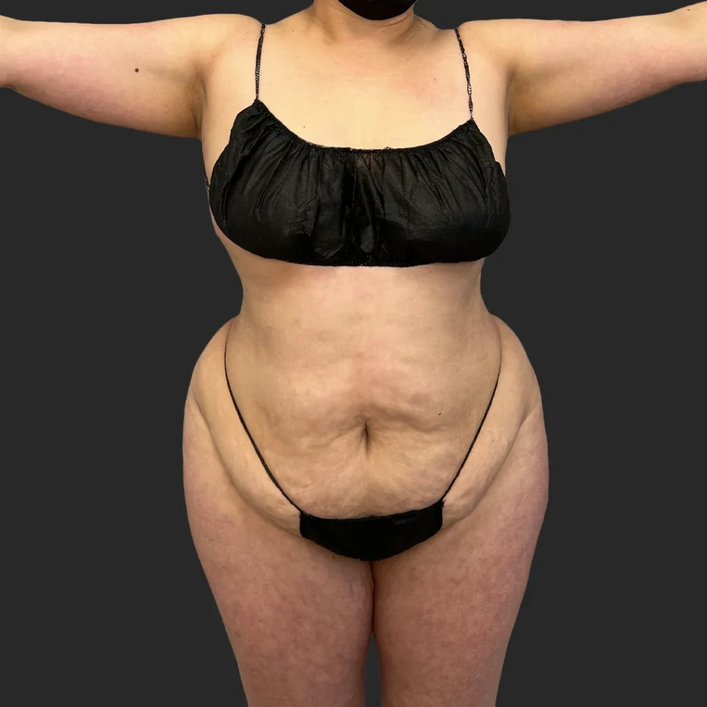 Additional before image